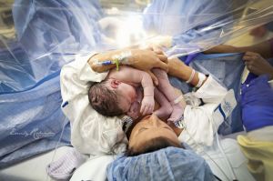 gentle c-section